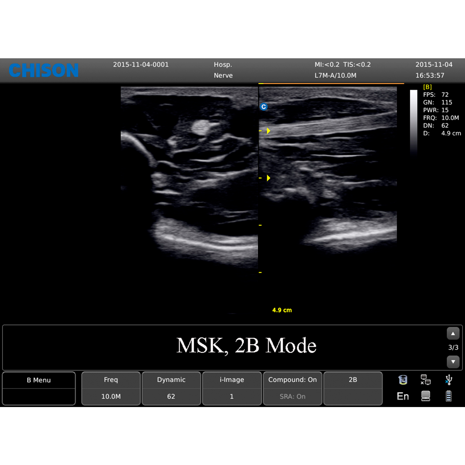 ECO 1 MSK 2BMode